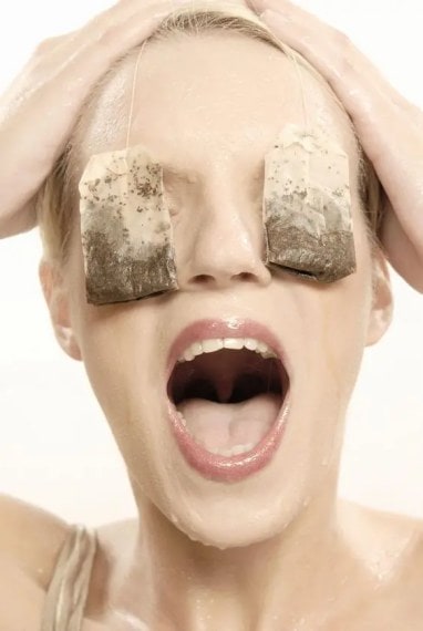 Lady with teabags resting on her eyes in order to remove puffiness from eyes. 