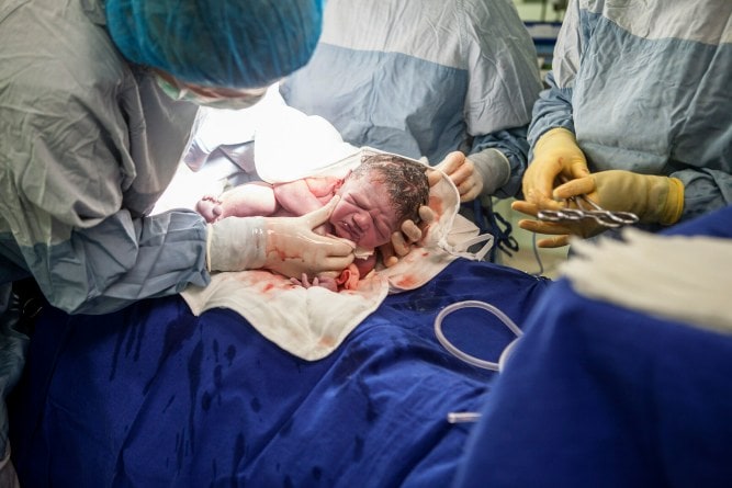 New born baby being held by nurse in operating theatre. 